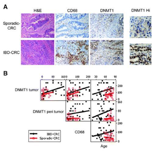 Mesenchymal-epithelial interaction Methylation in stromal cells IL-6 stabilises DNA methyltransferase 1 DNMT1 expression higher in CAC than sporadic CRC samples Increased DNMT1