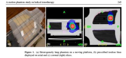 Designed by Ke Sheng,, Ph.D. and fabricated at UVA Programmable step motor allows for computer driven lung motion profiles Lung Phantom SBRT Dosimetry Effect of
