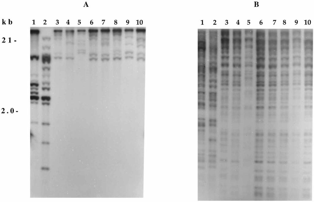 VOL. 35, 1997 NOTES 963 FIG. 1. Autoradiograms of EcoRI-digested DNA from reference Candida strains and atypical Candida isolates hybridized with the C.
