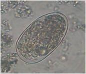 Salt floatation method had similar identification rate for eggs of Ascaris, hookworms, H.nana and in Giardia cysts.