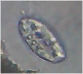 method mount (Saline /Iodine mount) Ascaris lumbricoides 4 3 3 2 Hook worm 13 10 11 7 Hymenolepis nana 9 8 9 4 Hymenolepis diminuta 1 0 0 0 Taenia spp 1 0 0 0