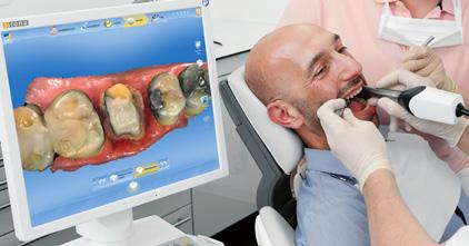 Enjoy intuitive design with the new user interface CEREC SW 4.