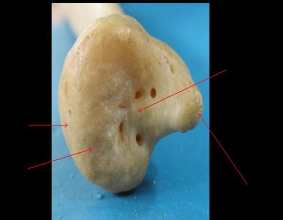 the head of ulna that would help improved results ulnar head replacement surgeries. Fig 2: Maximum height of seat (SH).