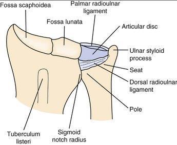Distal radio-ulnar joint The distal synovial radioulnar joint is a pivot-joint formed between the head of
