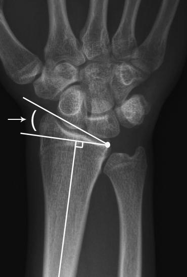 16 Chapter 1 consists of a lateral view and a posteroanterior (PA) view. 16 Radiographs must be made by using reproducible, controlled techniques.