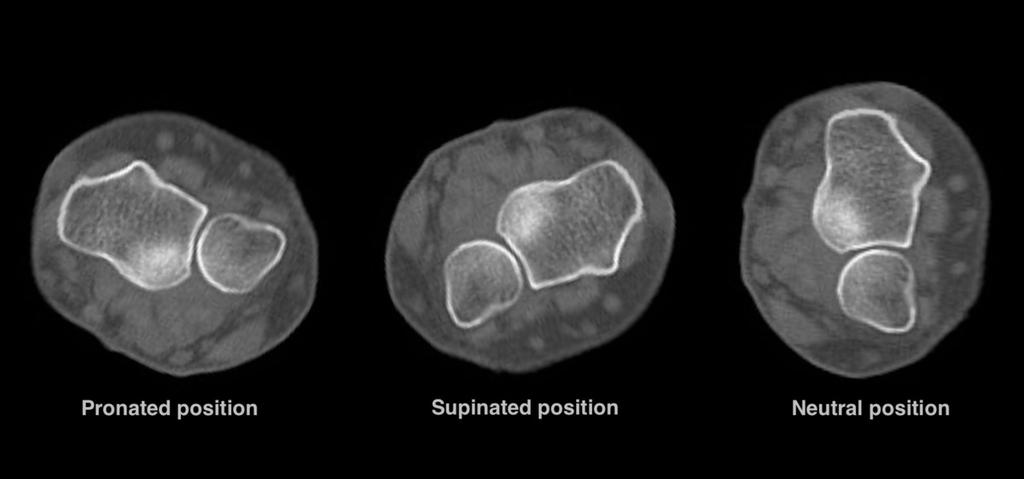 Fig. 6: Axial CT images demonstrating the different positions