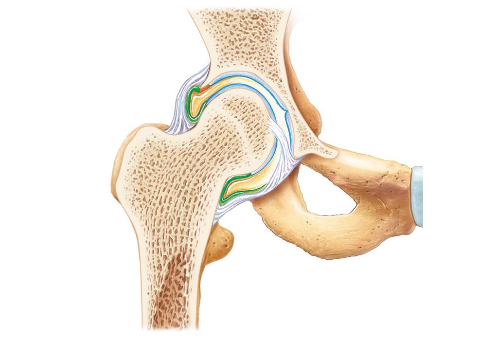 limited by the deep socket cartilage Acetabular labrum Femur Coxal (hip) bone Ligament of the head of the femur (um