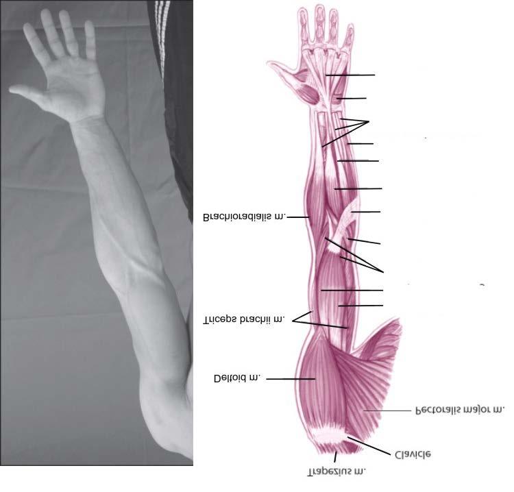 Anterior Muscles http://www.