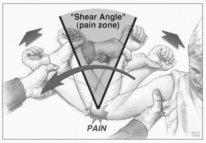 Symptoms Medial elbow pain, especially during the acceleration phase of the overhead throw.