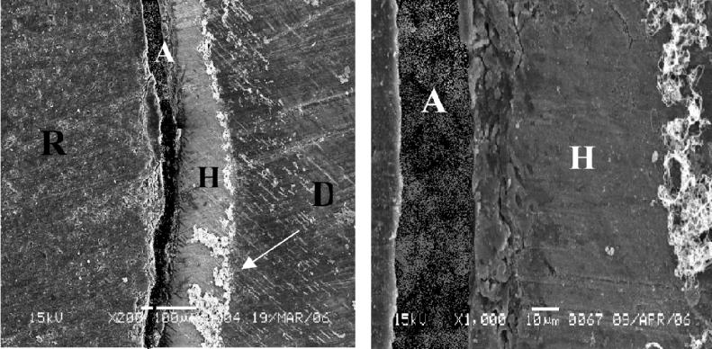 Low and high magnification (200x and 1000x) SEM image of the interface between Grandio Flow resin composite and dentin. No gap was seen at the interface.