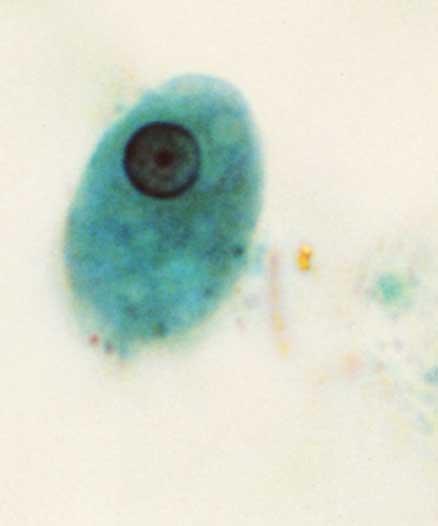 PROTOZOAN TYPE OF ENDOPARASITE PROTOZOAN-THE SIMPLEST ORGANISMS IN THE ANIMAL KINGDOM.
