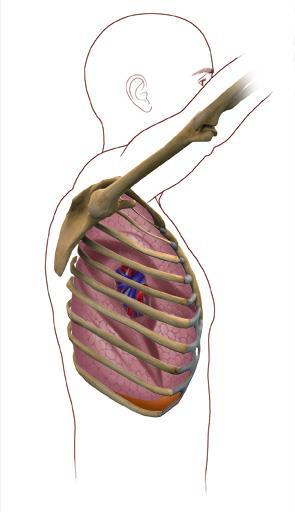 RUL: my first VATS lobe Auscultory Incision (optional) beneath scapula Staples: SPV Anter Trunk Artery Camera