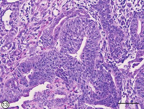 SUPPLEMENTARY FIG. S13. Teratocarcinoma.