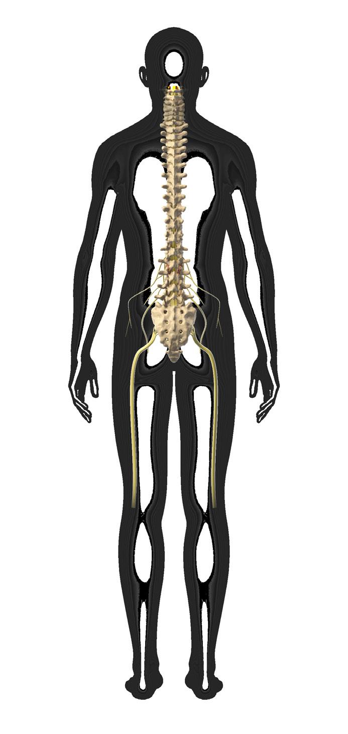 What is Radiculopathy? Radiculopathy is a symptom of an underlying spinal condition that compresses or irritates spinal nerves.