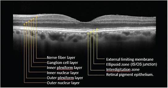 Retinal Layers Pre-retinal