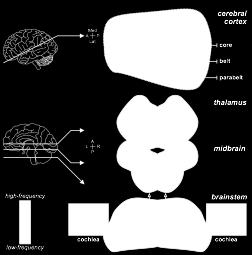 Topographic organization of the primary auditory cortex (A1) Tonotopy encodes sound frequency.