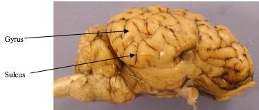 No actual cutting of the brain is required for this portion of the dissection.