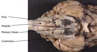 2. Next locate the area referred to as the brain stem. This area is made up of the pons, medulla, and cerebellum.