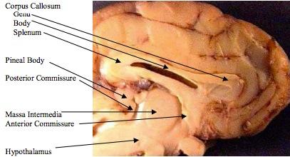part of the mid brain. 7. This is a more detailed view of the mid-sagittal section.
