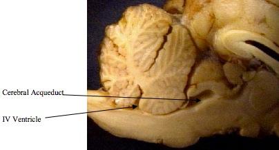 8. Now you are looking at the cerebellum.