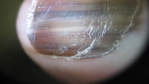 ventral ) nail plate Nail folds
