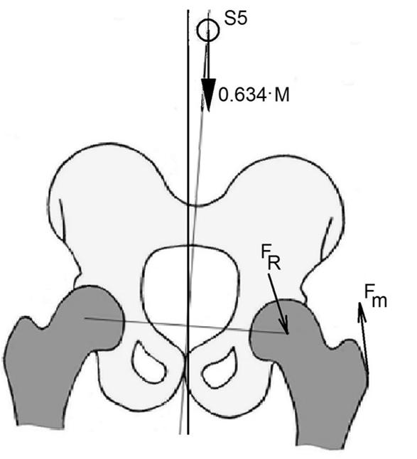 of the proximal femoral bone in the case of bipodal and unipodal support.
