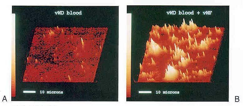 Exposure of blood to collagen membrane Left