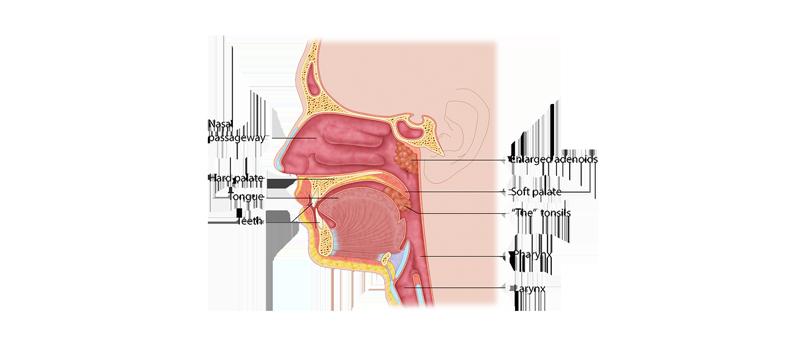 The tonsils are a collection of cells and immune tissue at the back of your throat that are responsible for fighting infection.