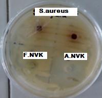 extracts s and fresh NVK decoction. Anthraquinones, glycosides, phlobatannins and saponins were not present in the extracts and fresh NVK decoction.