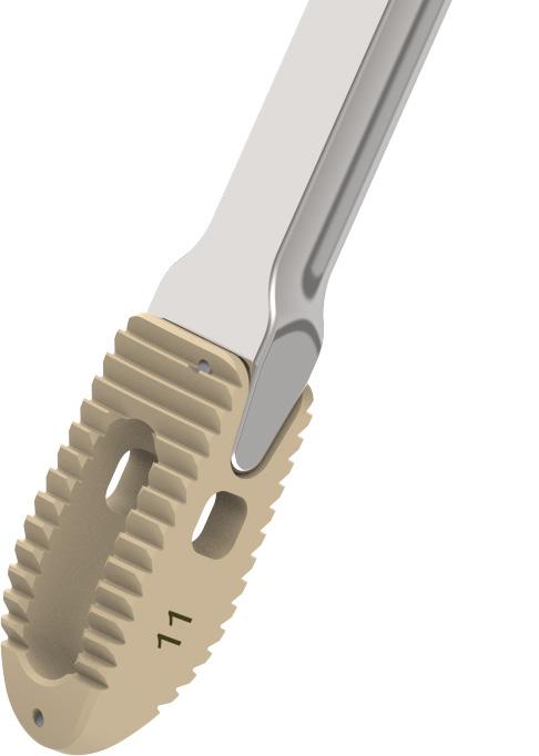 Engage the forks of the Inserter into the female treaded portion of the implant Insert the