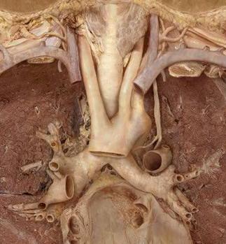 Page3 Cardiovascular system, thorax, arteries-anterior, dissection layer 5 3. aorta a. aortic arch b. brachiocephalic c. left common carotid d. left subclavian 1.