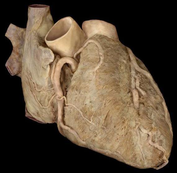 3b 3c 3a 3d APR Fig. 3 Cardiovascular system, heart, vasculature-anterior, dissection layer 2 6. coronary arteries 7. pulmonary arteries (not shown in this view) 8.