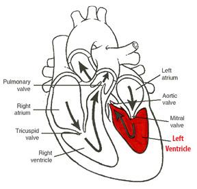 The vestibule is a smooth walled part of the left ventricle