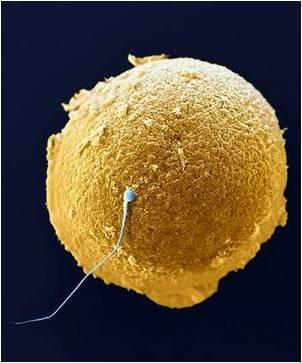 Assisted reproductive technology (ART): manipulation of gametes (sperm and eggs) outside the body to enable