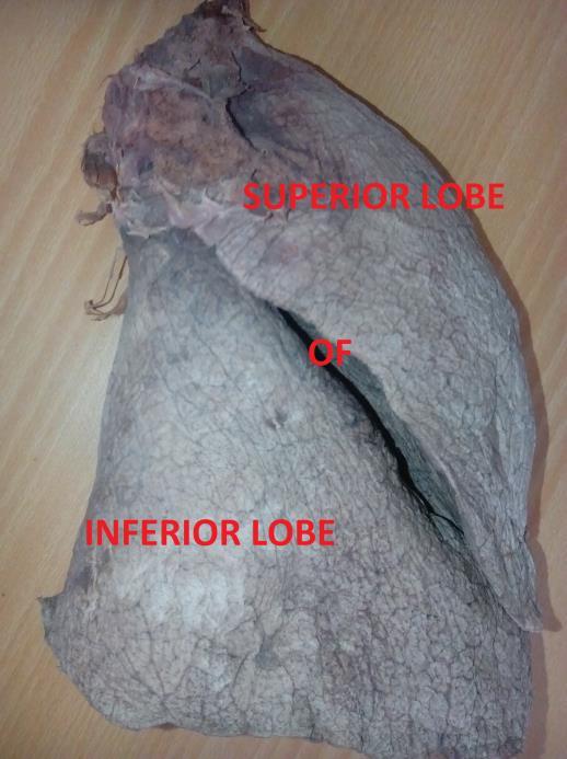 1.INTRODUCTION The fissures are conducive to uniform expansion of lobes. They provide routes for movements of lobes in relation to each other.
