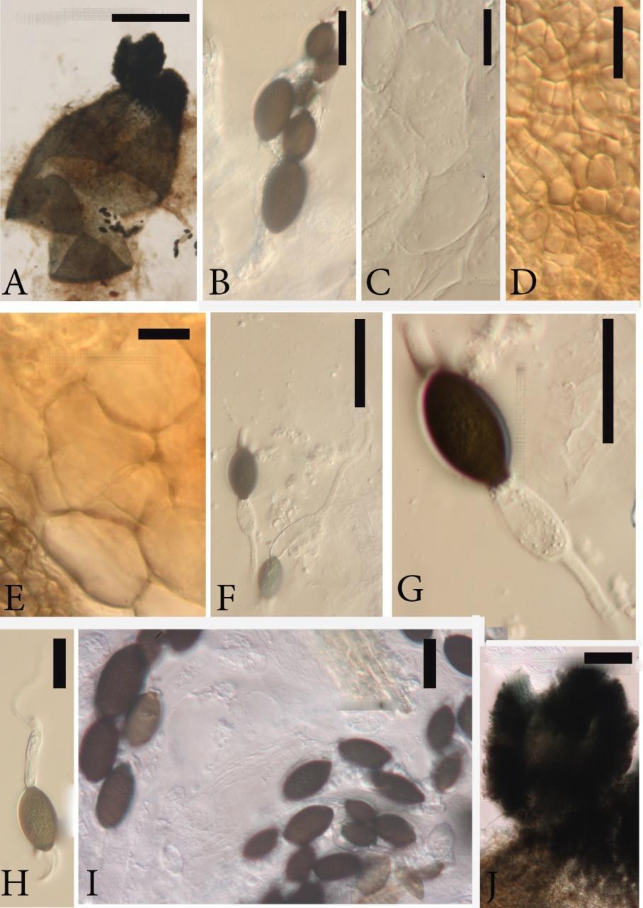 Fig. 9 Podospora hyalopilosa (from MFLU10 0196). A Squashed perithecium. B Ascus with mature ascospores very different in size. C Bases of paraphyses intergrading with cells of endoperidium.