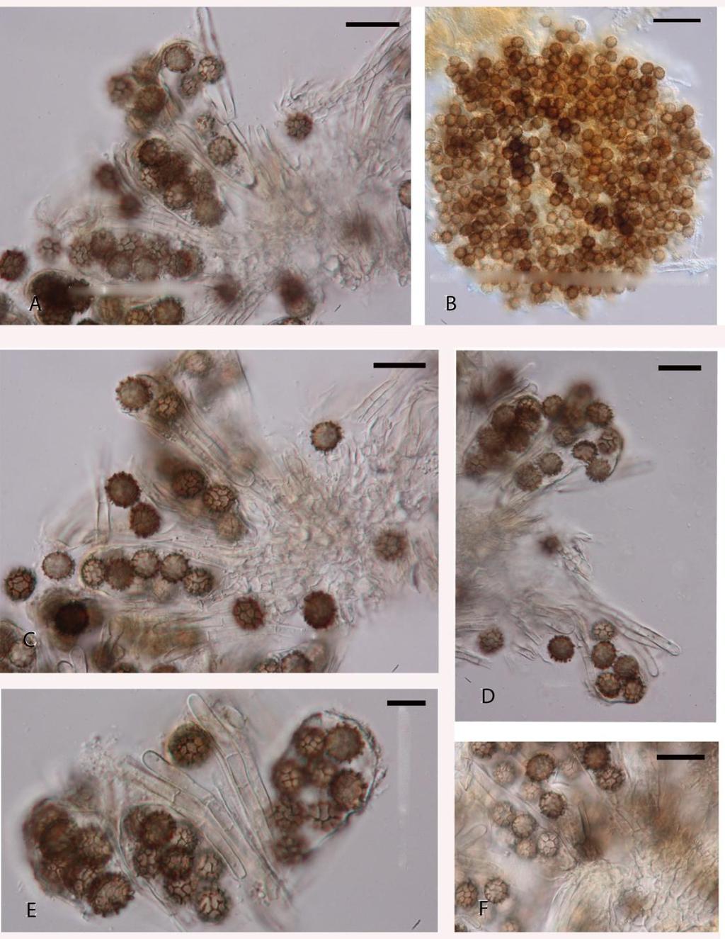 Fig. 2 Ascodesmis sphaerospora (from MFLU10 0189). A Asci and ascospores showing attachment to basal cells. B Ascoma water mount. C D Asci, paraphyses and ascospores. E Asci. F Ascospores.