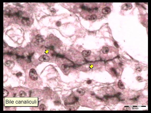 6 leaves the liver via: Bile canaliculi bile ducts common hepaac duct cysac duct common bile duct