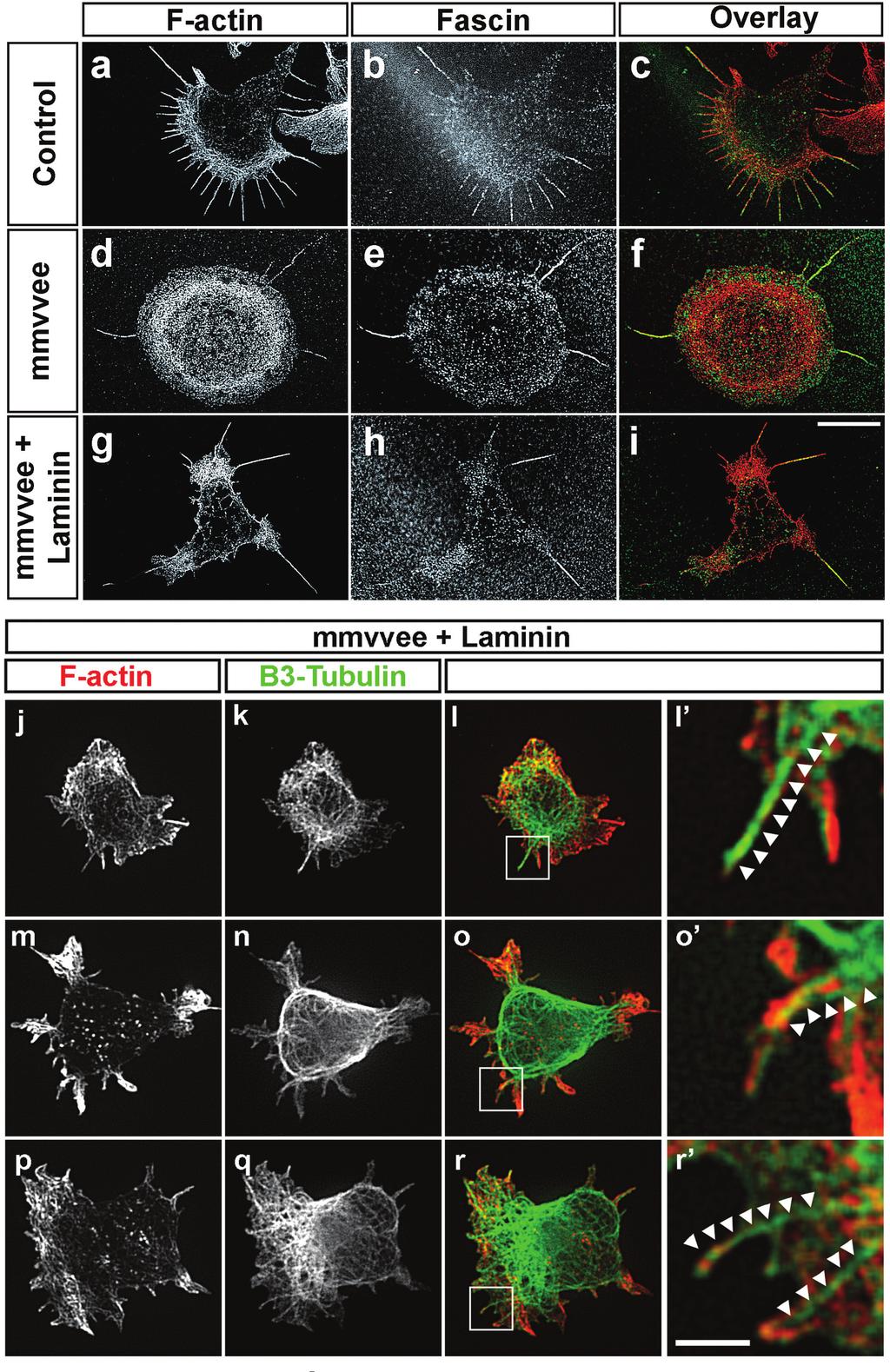 S U P P L E M E N TA R Y I N F O R M AT I O N Figure S4. Filopodia and actin-rich filopodia-like extensions that form after laminin addition contain fascin and are invaded by microtubules.