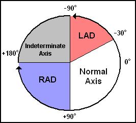The QRS Axis Represents the overall direction of the
