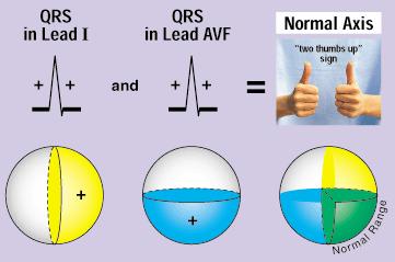 The Quadrant Approach QRS