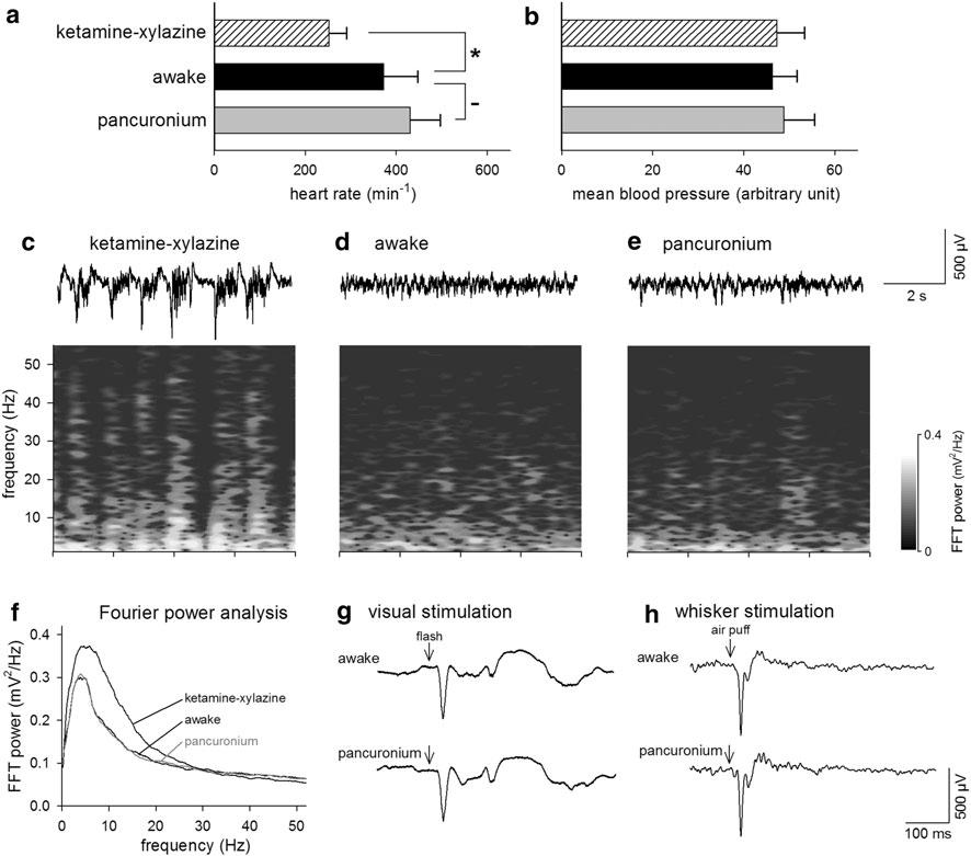 J Physiol Sci (2011) 61:343 348 345 Fig. 1 Pancuronium does not affect heart rate, mean blood pressure, or local field potentials of the cortical superficial layer in the mouse.