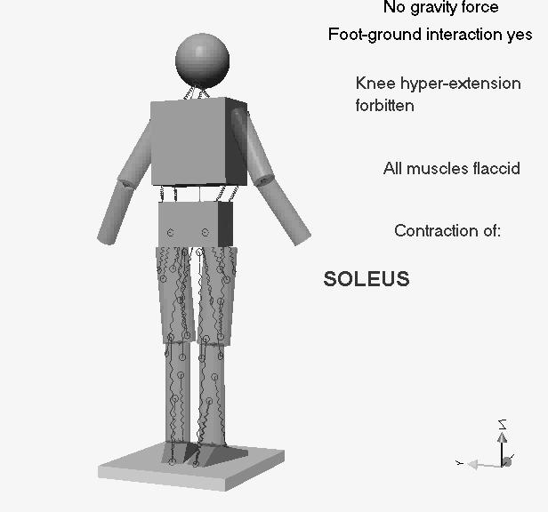 Functional hip malrotation Think of triceps surae - Older patients:
