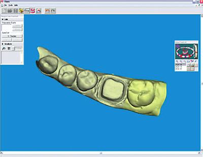 9 Figure 5: Scanned Abutments (Sample image) as it