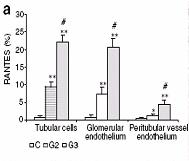 Figure 6 Immunostaining of RANTES in renal tissue.