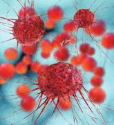 Blast Phase Chronic Myelogenous Leukemia Benjamin Powers, MD; and Suman Kambhampati, MD The dramatic improvement in survival with tyrosine kinase inhibitors has not been demonstrated in the advanced