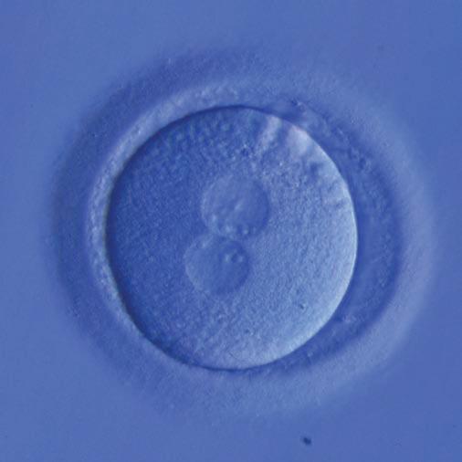 embryos are transferred into the uterus which is already prepared by appropriate hormonal