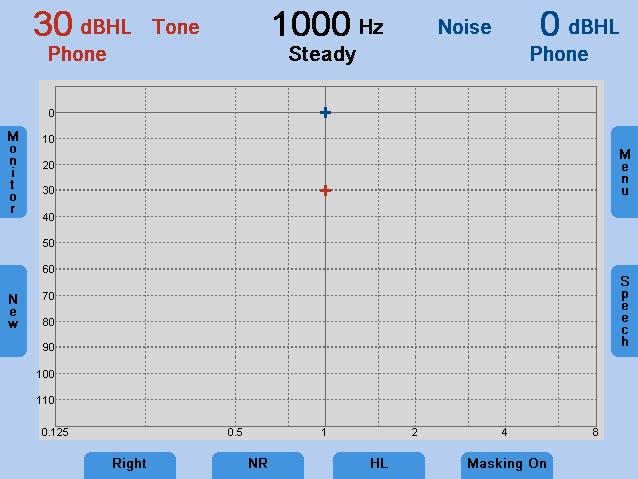 Manual Masking The masking is switched on by pressing the Masking On/Off button (15). The channel of the non-test ear is switched on and set to noise with a level of 0 dbhl.