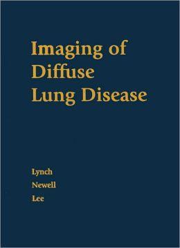 Suspected diffused lung disease Specific CT pattern(uip,eg,lam,h P, Lipoid Pneumonia) CT pattern suggestive of HP sarcoid, lymphagitic carcinoma,pap, alveolar carcinoma,eosinophillic