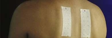 Patch test Evaluation of